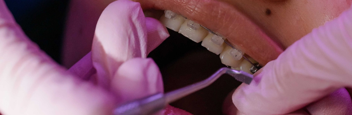 Dental Implant Centre Cover Image