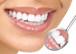 Orthodontic Treatment: Braces Dental Clinic in Surat