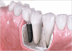 Best Dental Clinic in Surat | Dentist in Surat | R.R. Dental n' Maxillofacial Clinic