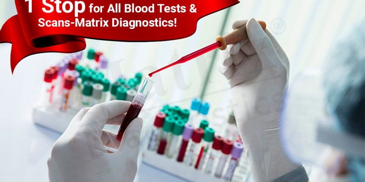 Blood Test In kphb  | Best Diagnostics - Matrix Diagnostics