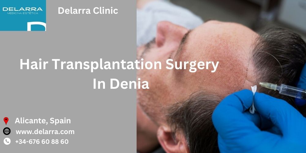 Conquer Hair Loss: Unraveling The Secrets To The Best Hair Transplant Surgery In Denia | TechPlanet