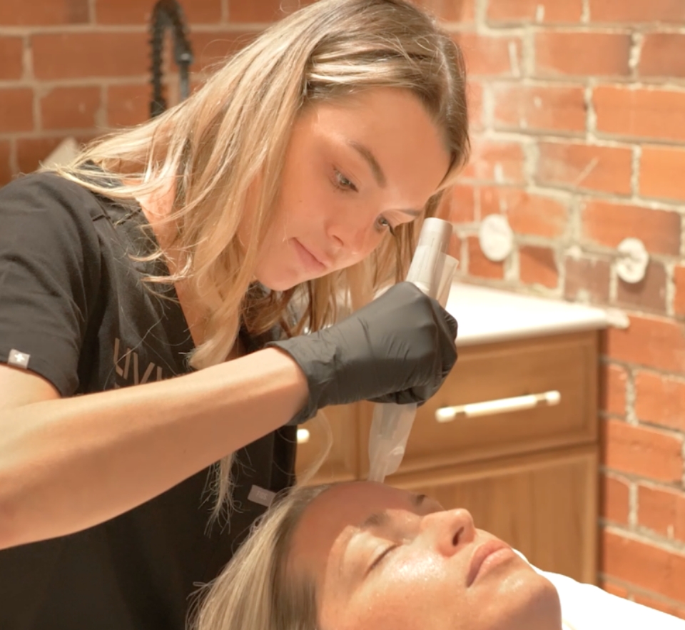 "PRP FACIAL" IN SAN DIEGO