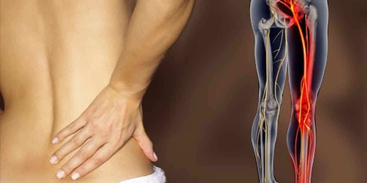How to Get Relief From Lumbar Radiculopathy Pain