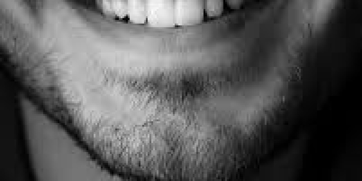 The Amazing Benefits Of Professional Teeth Whitening In Melbourne