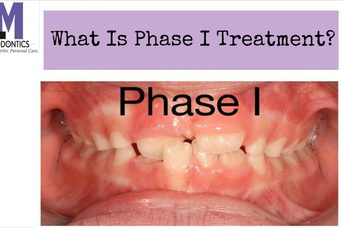 Phase 1 vs. Phase 2 Orthodontic Treatment: What's the Difference? | TheAmberPost