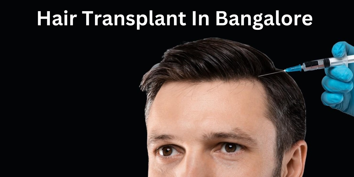 Know all About Revision Hair Transplant