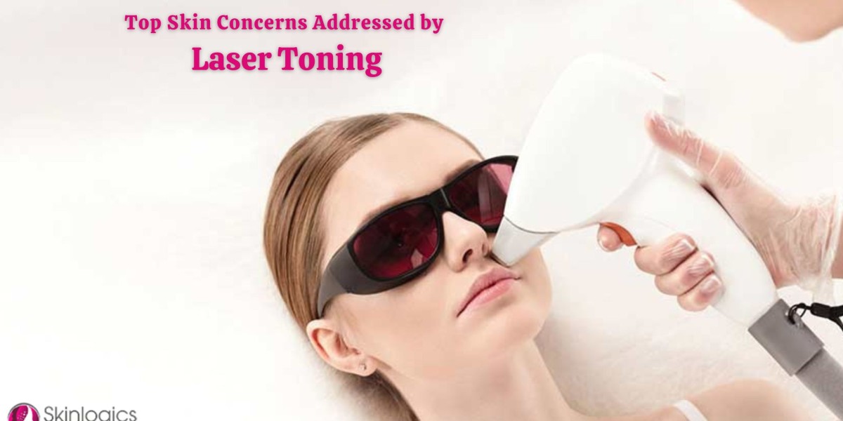 Top Skin Concerns Addressed by Laser Toning