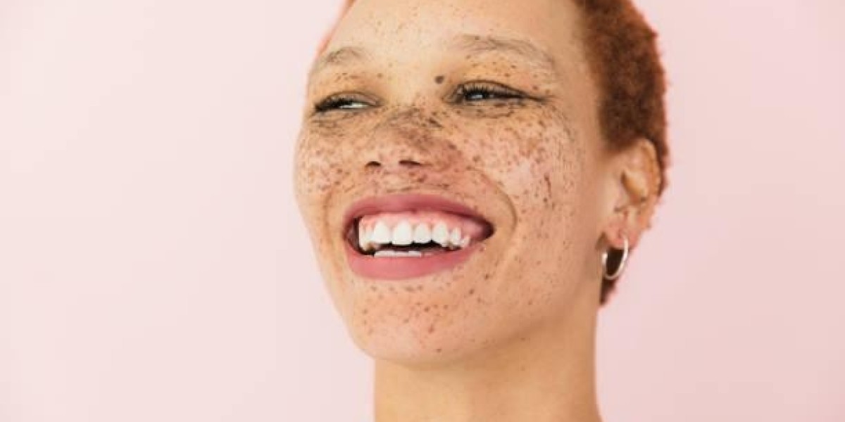 Get Rid of Freckles Laser: Understanding the Process and Benefits