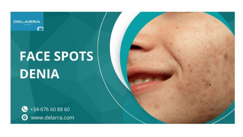 The Ultimate Face Spots Denia Treatment Guide: 5 Proven Methods | Times Square Reporter