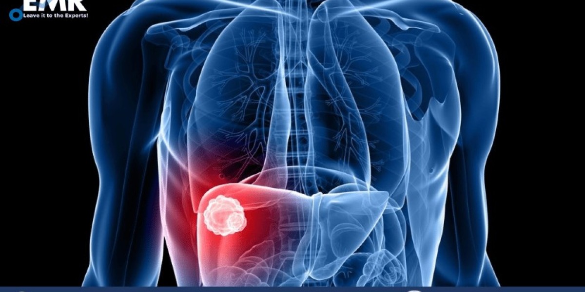 Unlocking Liver Cancer Screening Market: Navigate with Ease and Confidence
