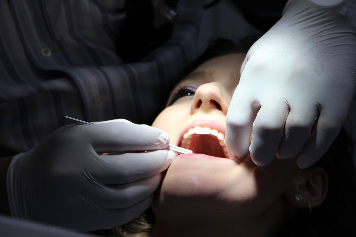 Wisdom teeth removal – a best oral health maintenance procedure – Hawthorn East Dental