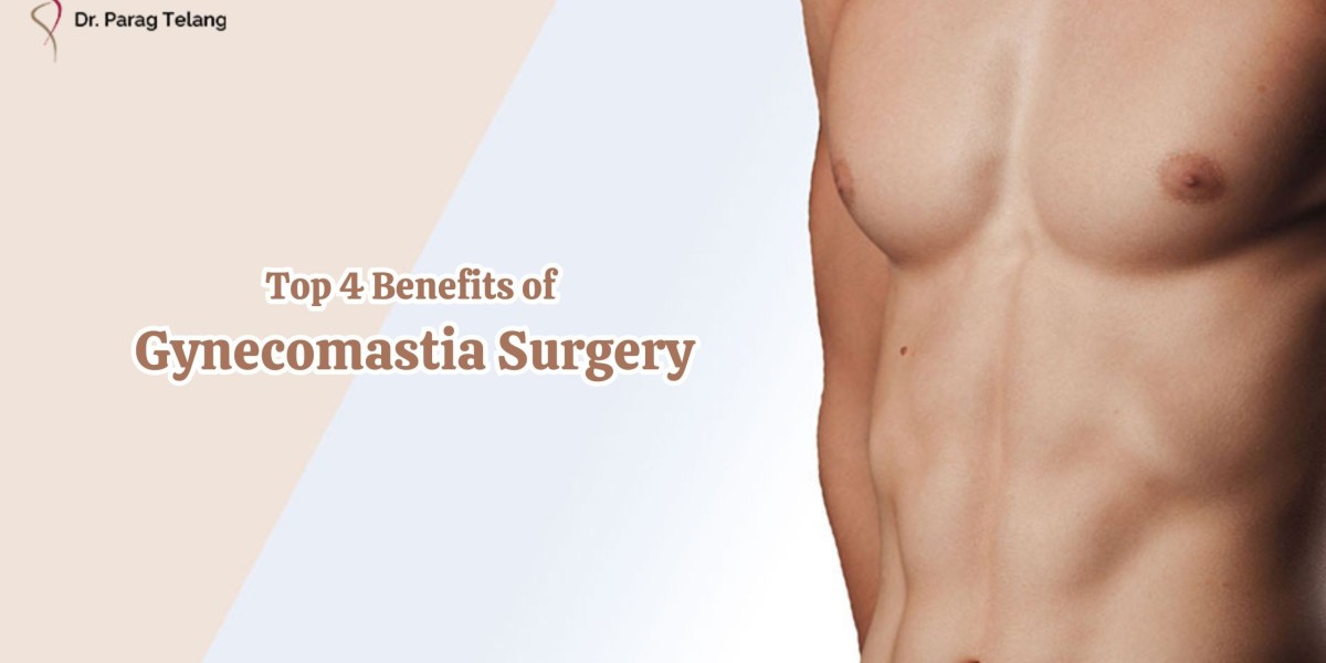 Top 4 Benefits of Gynecomastia Surgery