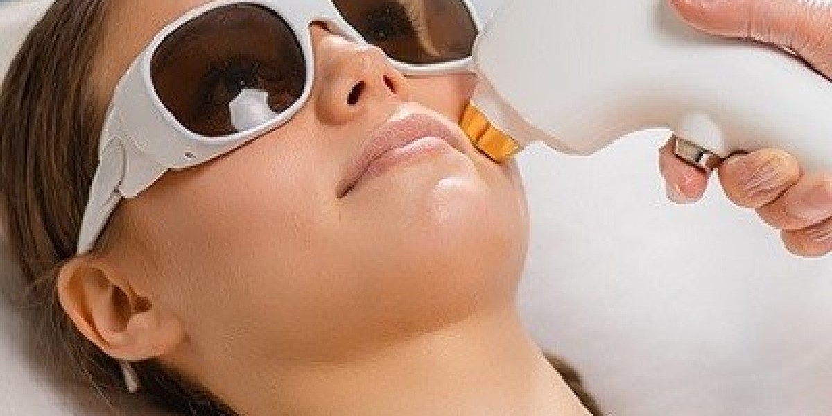 Embracing Smooth Skin: The Journey of Laser Hair Removal