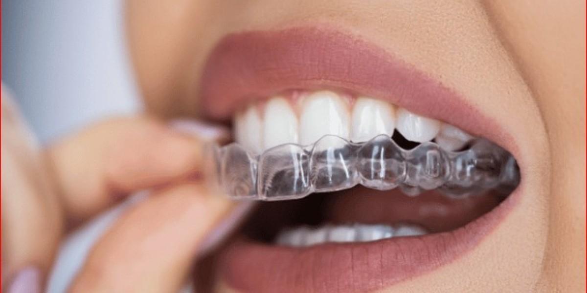 Unlocking the Power of Straight Teeth: Why a Beautiful Smile Matters More Than You Think
