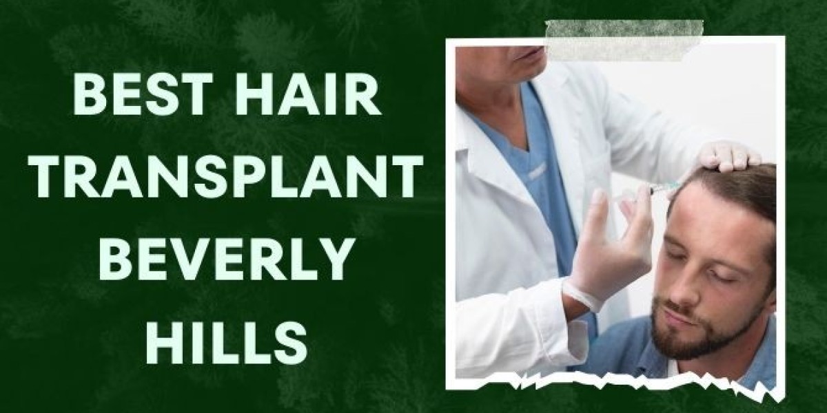 10 Steps to Get the Perfect Hair Transplant in Beverly Hills