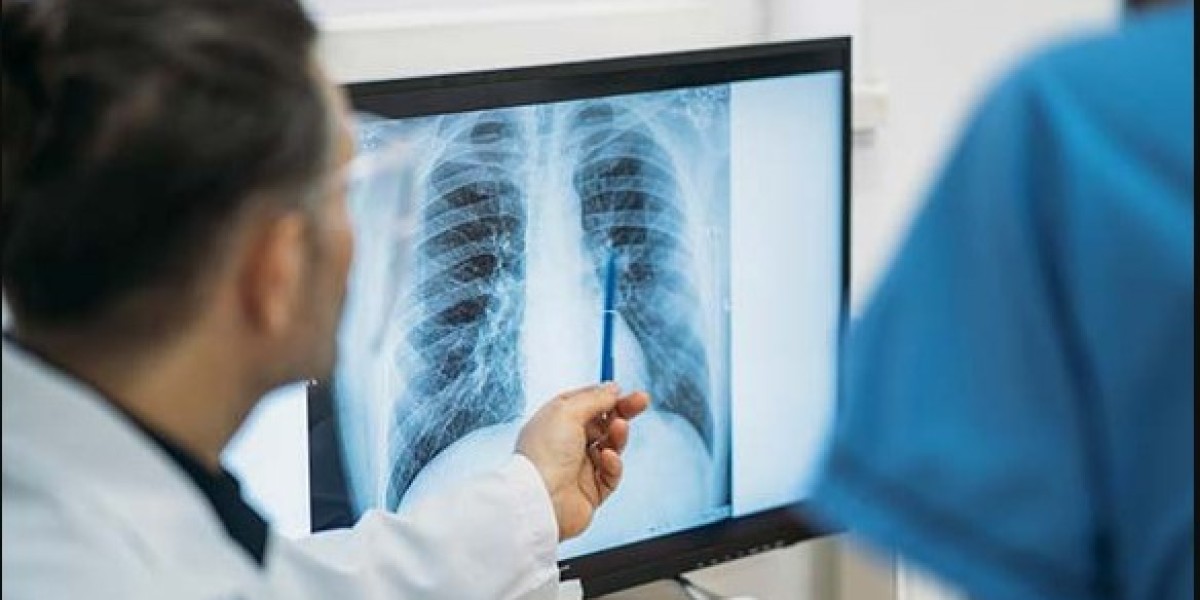 Navigating the World of Digital X-Ray Services in Watauga