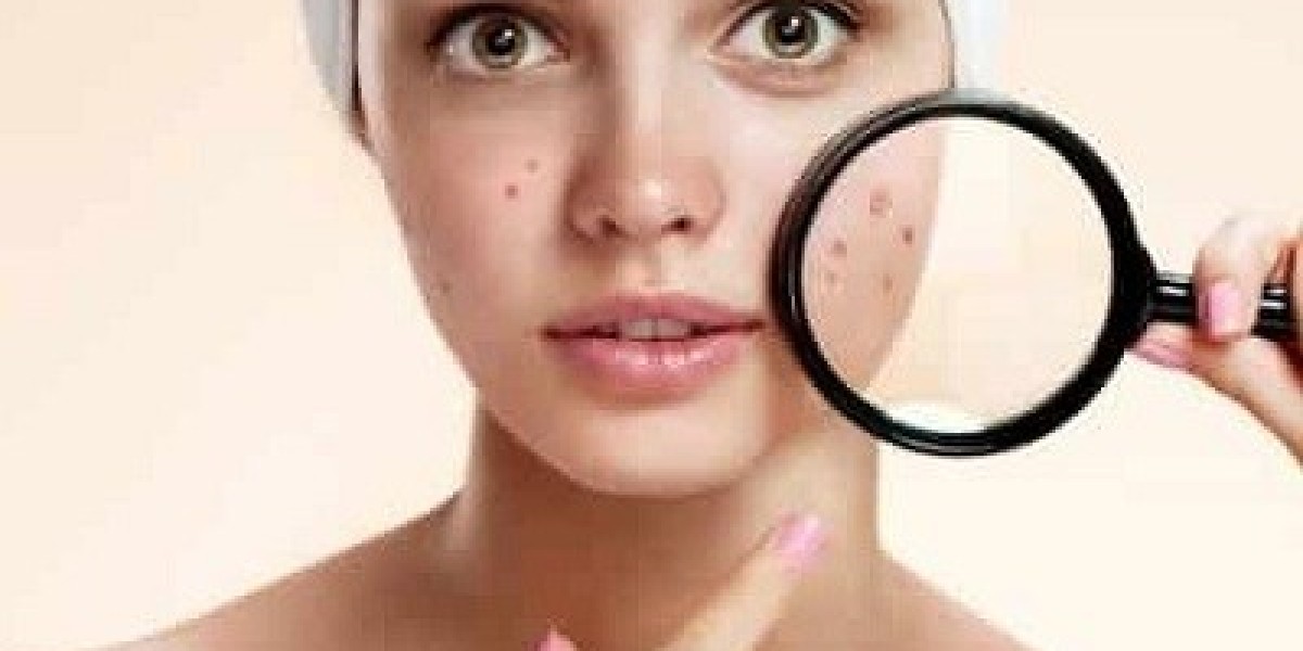 Reclaiming Confidence: The Journey to Treating Acne Scars