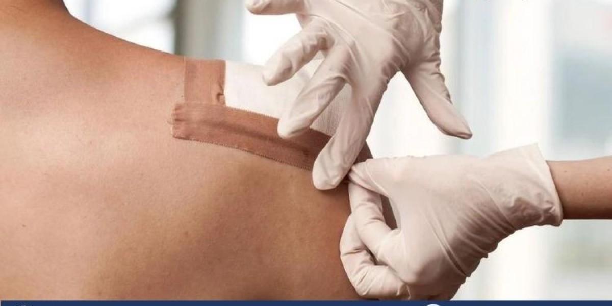 Biomaterial Wound Dressing Market Size, Share, Trends, Growth, Analysis, Report and Forecast 2024-2032
