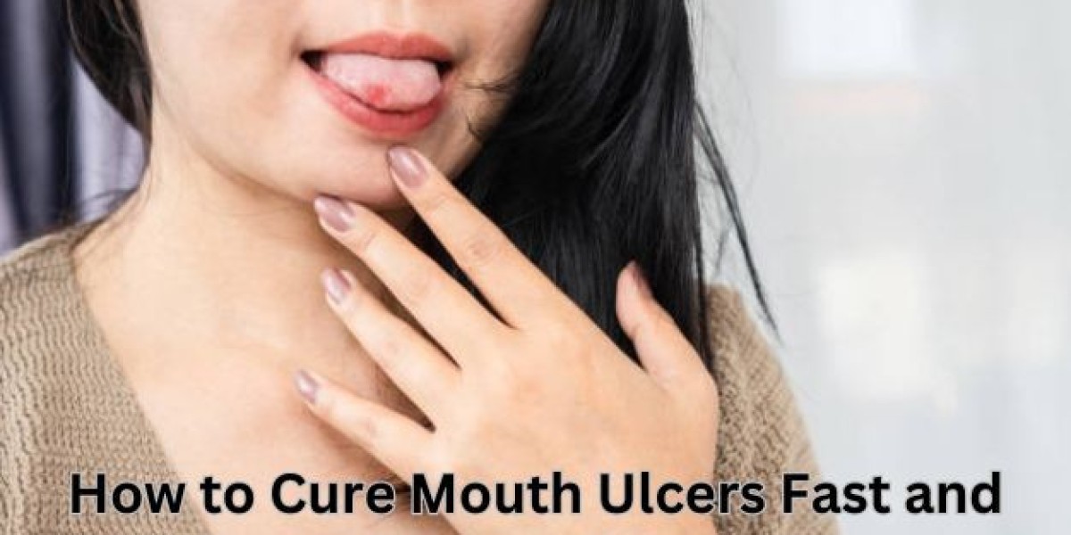 Speedy Recovery: Natural Techniques to Cure Mouth Ulcers Quickly