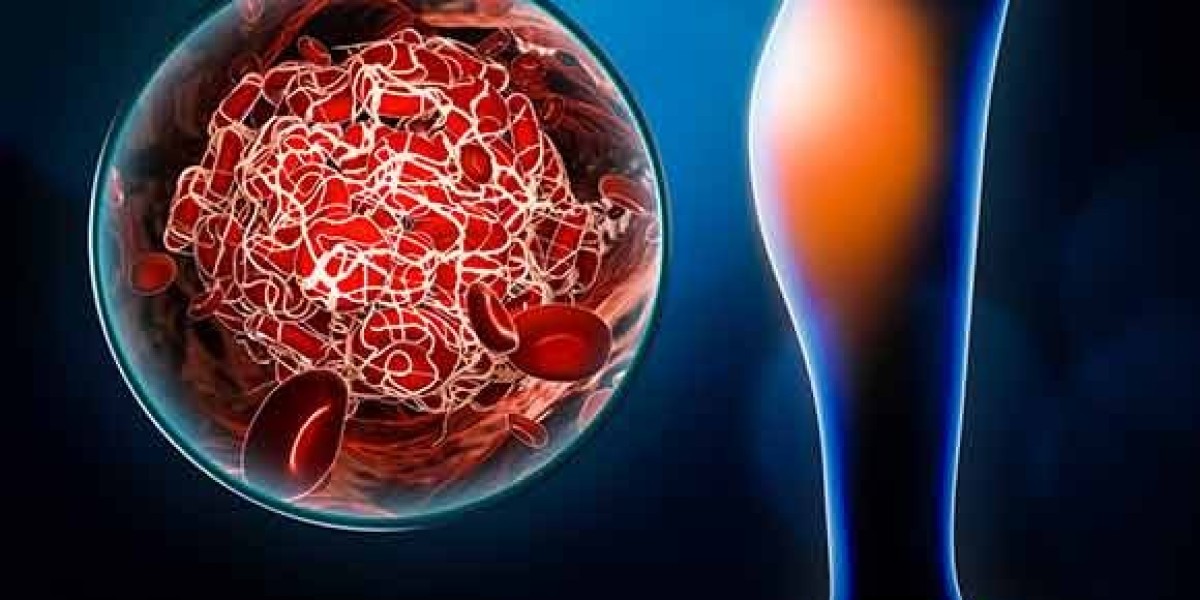 Deep Vein Thrombosis Market Size and Growth Rate Analysis for 2024-2034| by IMARC Group