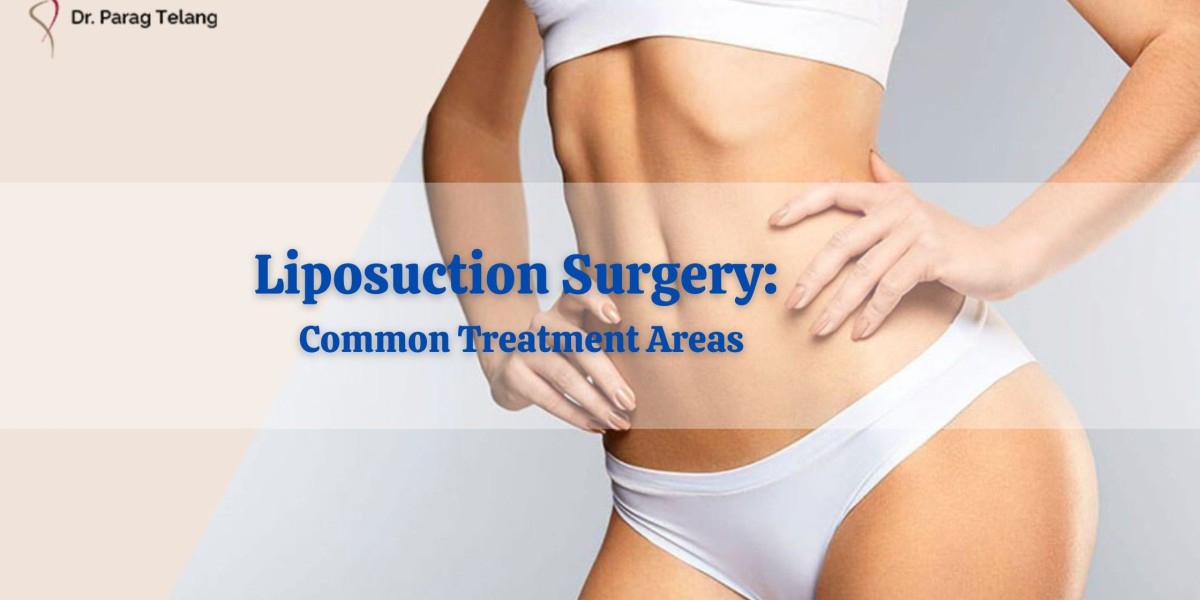 Liposuction Surgery: Common Treatment Areas