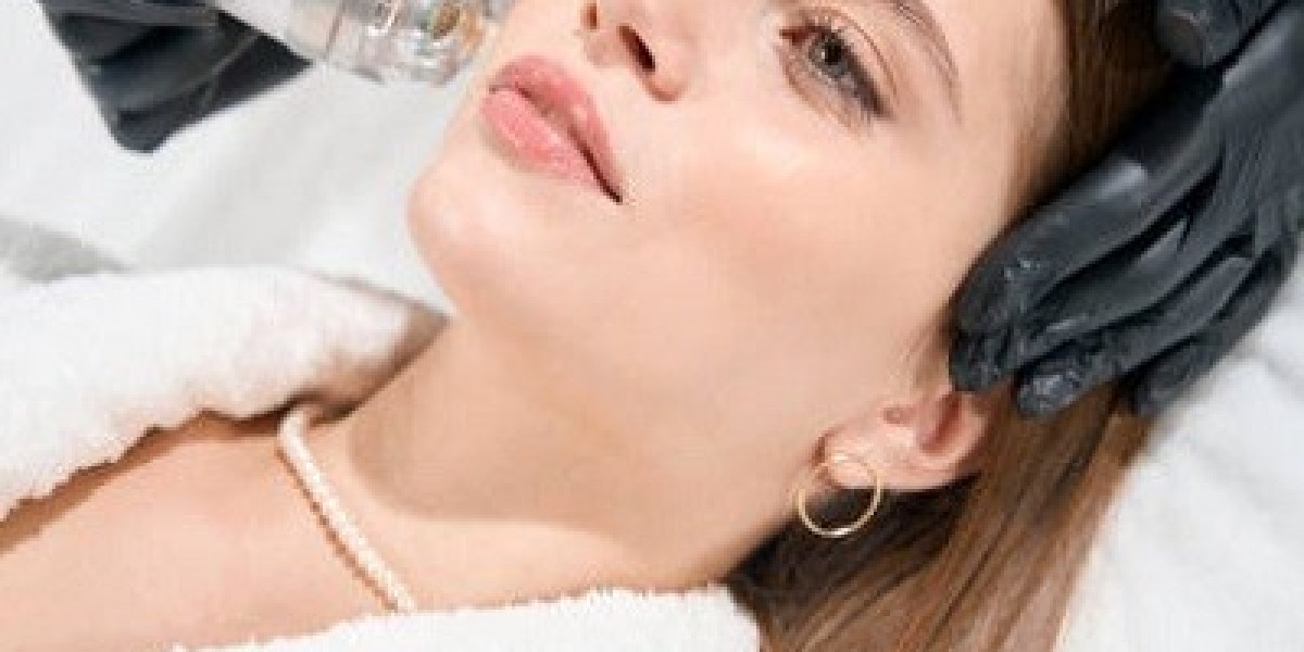 The Ultimate Guide to Microneedling: Benefits, Process, and Aftercare
