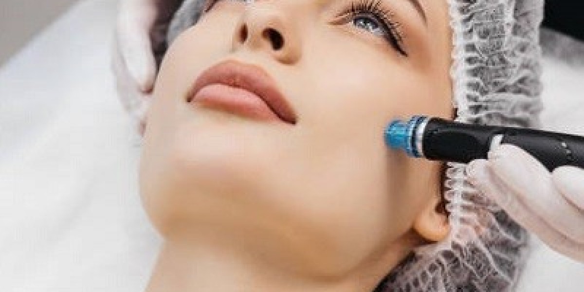 Microneedling: Your Pathway to Revitalized Skin