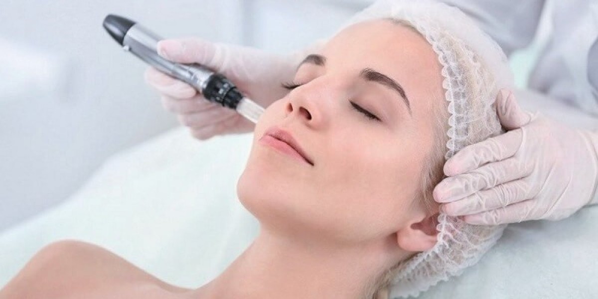Microneedling and Chemical Peels: A Powerful Combination