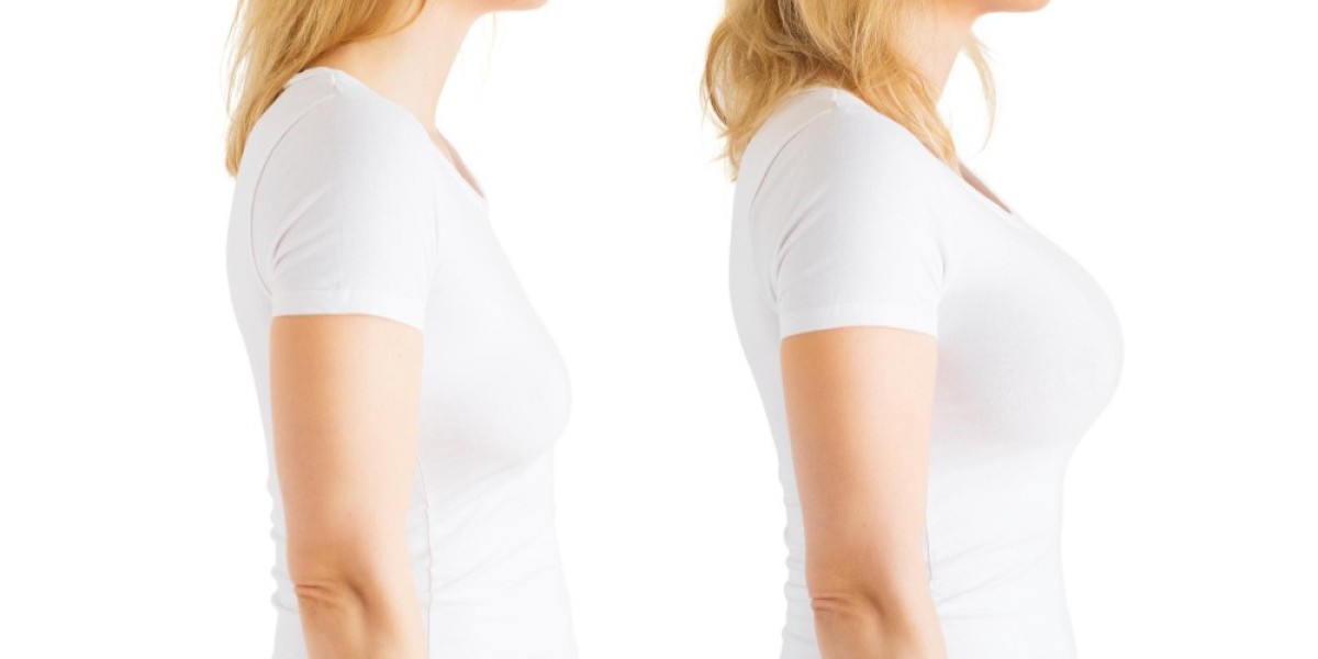 Factors to Consider When Choosing a Clinic for Your Breast Lift Procedure in Dubai