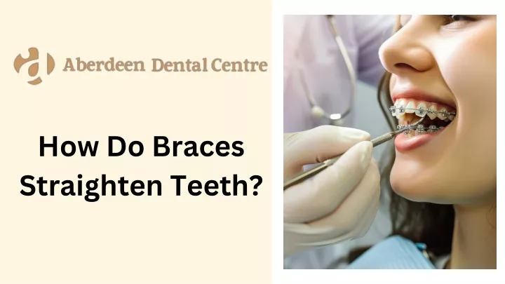 PPT - How Do Braces Straighten Teeth? PowerPoint Presentation, free download - ID:13357060