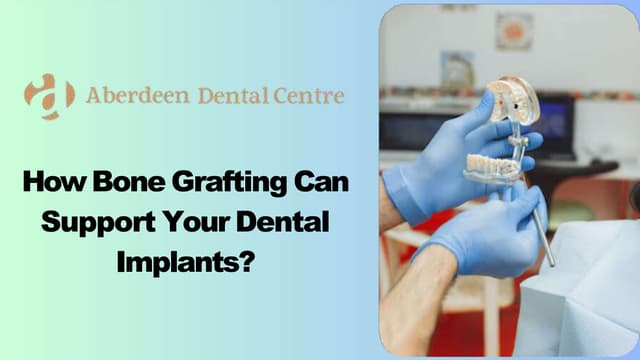 How Bone Grafting Can Support Your Dental Implants? | PPT