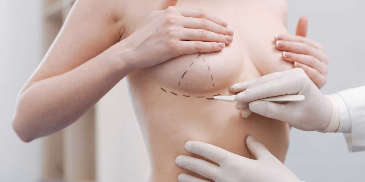 Breast Augmentation How to Find the Best Surgeon for Your Procedure