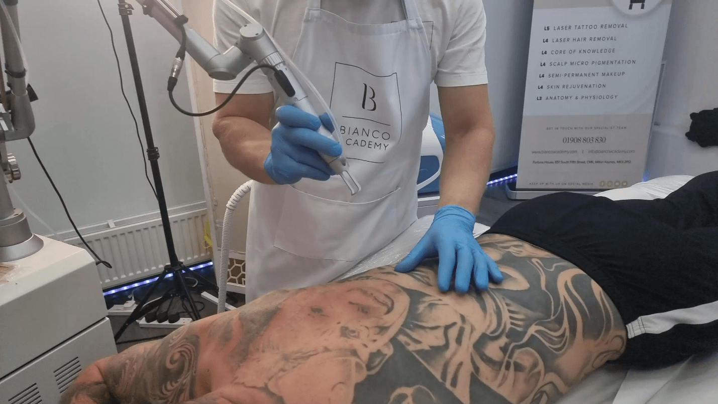 Laser Tattoo Removal Training Benefits: Why Should You Join?