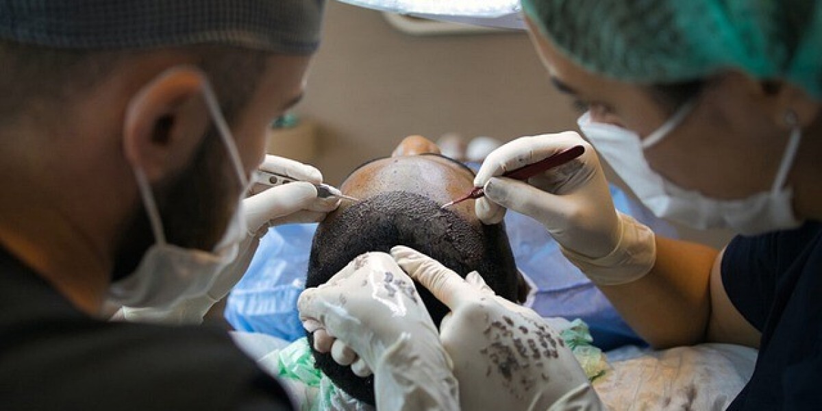 Finding the Best Hair Transplant Center in Indore: Your Guide to Reehairskin