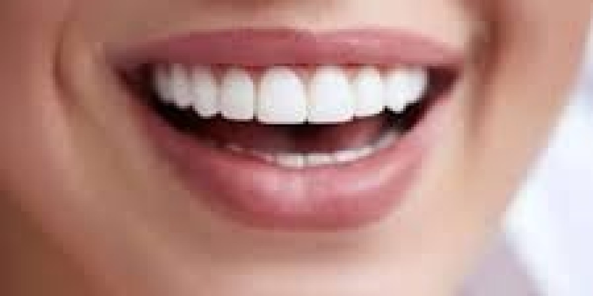 Affordable and Effective Teeth Whitening in Dubai