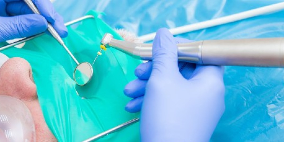 Understanding Root Canals: Myths Facts and Everything You Need to Know