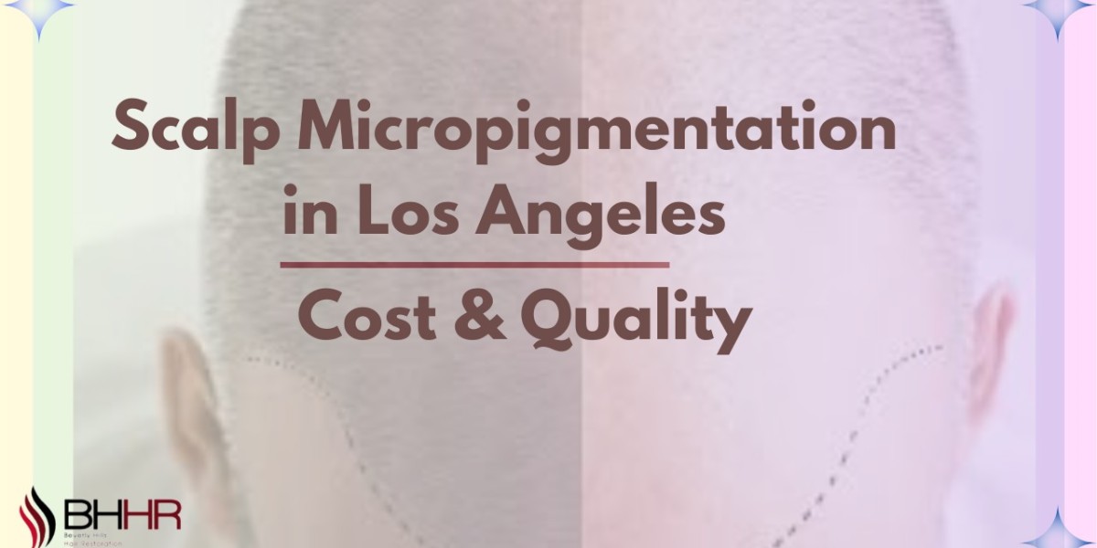 Scalp Micropigmentation in Los Angeles: Cost & Quality