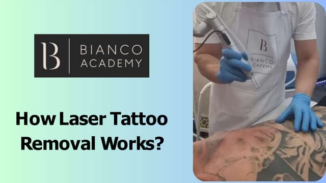 How Laser Tattoo Removal Works? | PPT