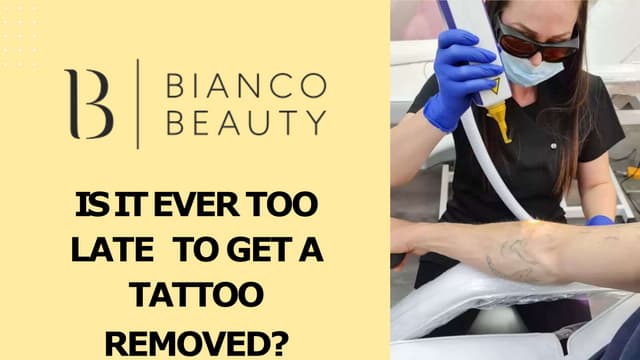 Is It Ever Too Late To Get A Tattoo Removed? | PPT