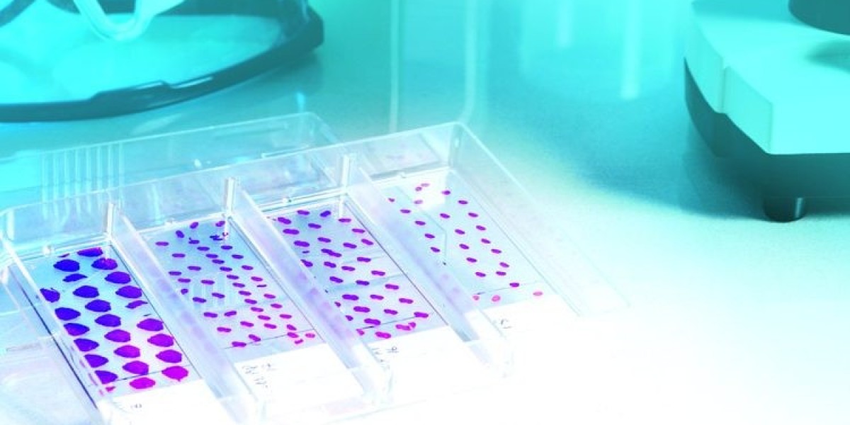Tissue Diagnostics Market Size, Trends, Key Player Analysis, and Report 2024-2032