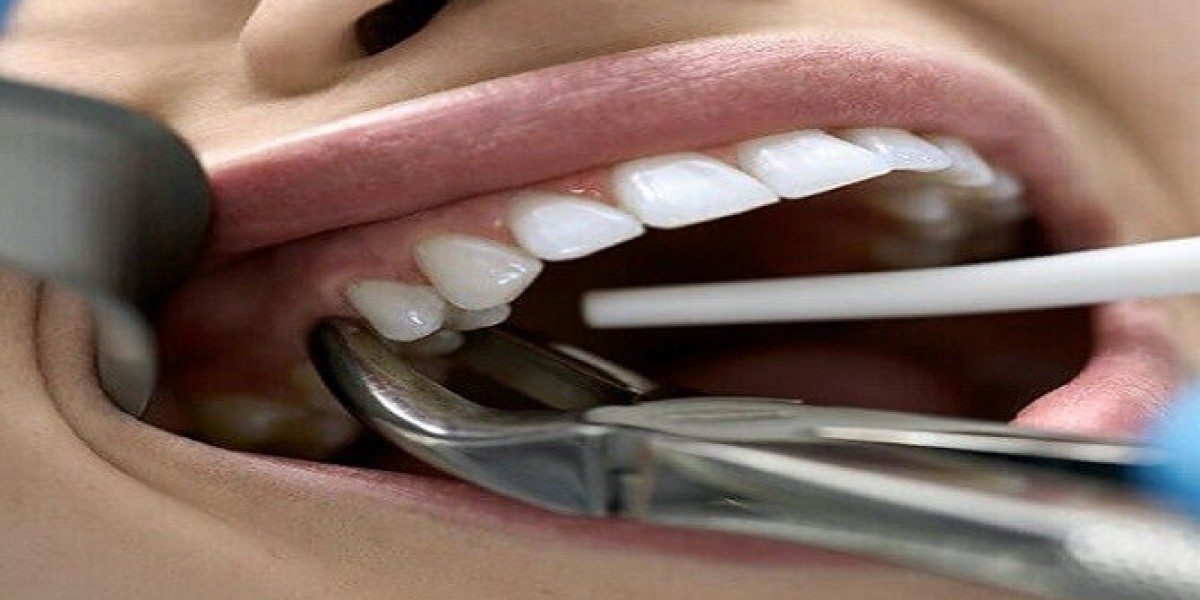 What Are the Risks of Tooth Extraction in Dubai?