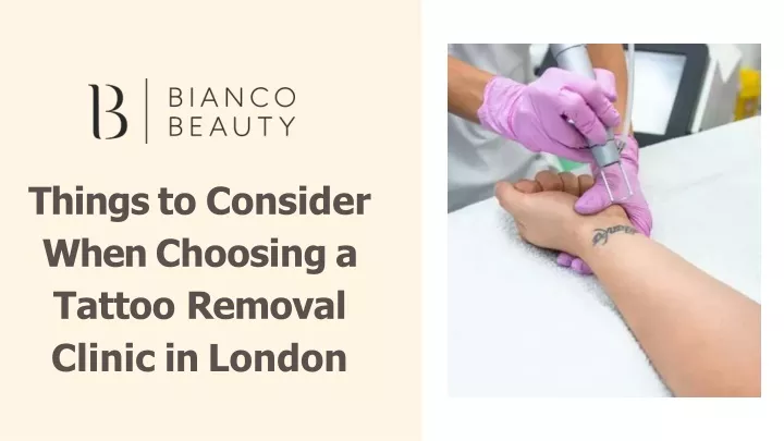 PPT - Things to Consider When Choosing a Tattoo Removal Clinic in London PowerPoint Presentation - ID:13371603