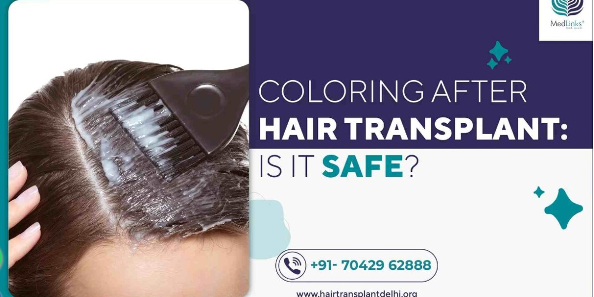 Coloring After Hair Transplant: Is It Safe