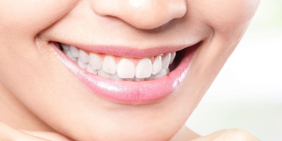 7 Ways to Save on Teeth Whitening Cost in Dubai