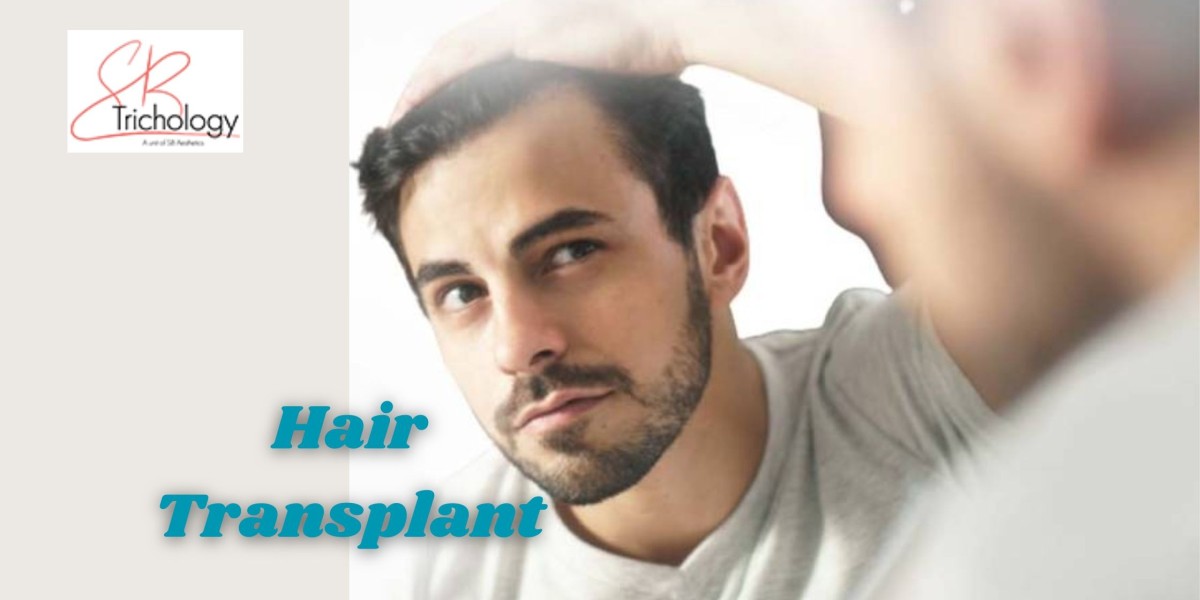 Am I a Good Candidate For Hair Transplant?