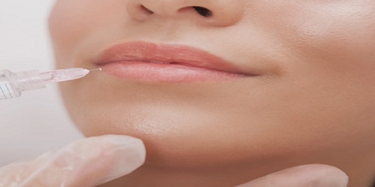 "Juvederm Fillers: Frequently Asked Questions"