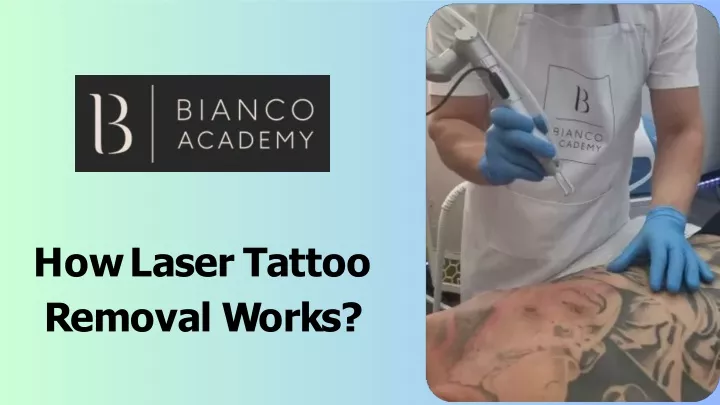 PPT - How Laser Tattoo Removal Works? PowerPoint Presentation, free download - ID:13367413