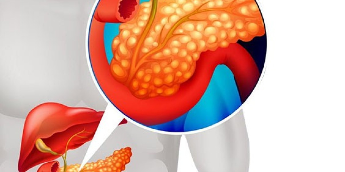 Pancreatic Cancer Market Analysis, Epidemiology, Trends and Forecast till 2024-2034