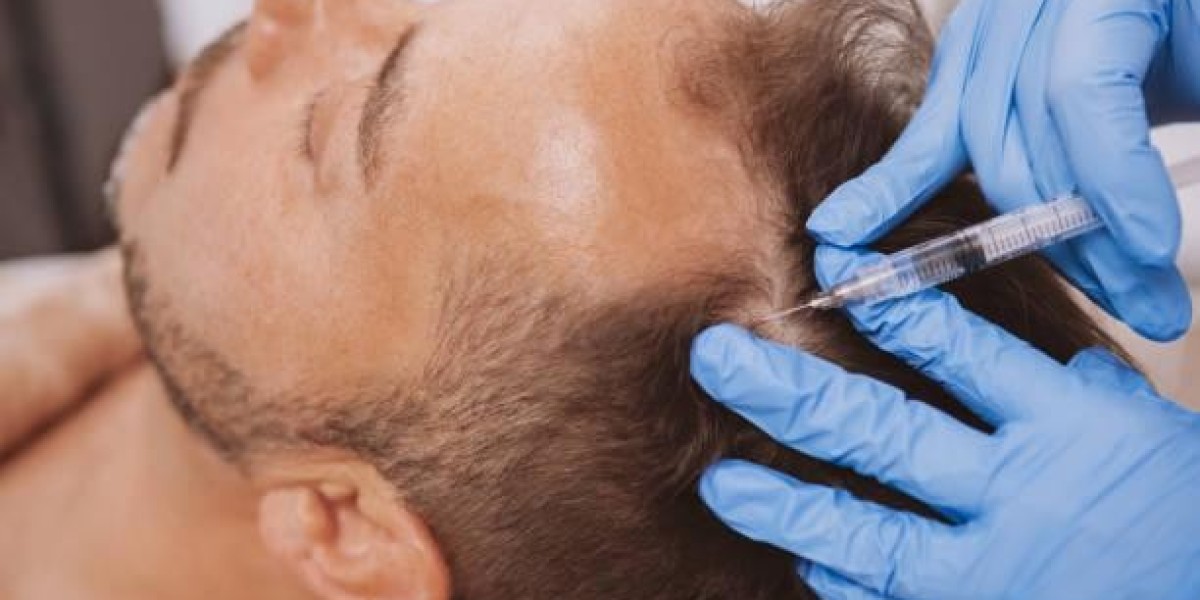 PRP Hair Treatment Success Rate: Evaluating the Effectiveness of Platelet-Rich Plasma Therapy