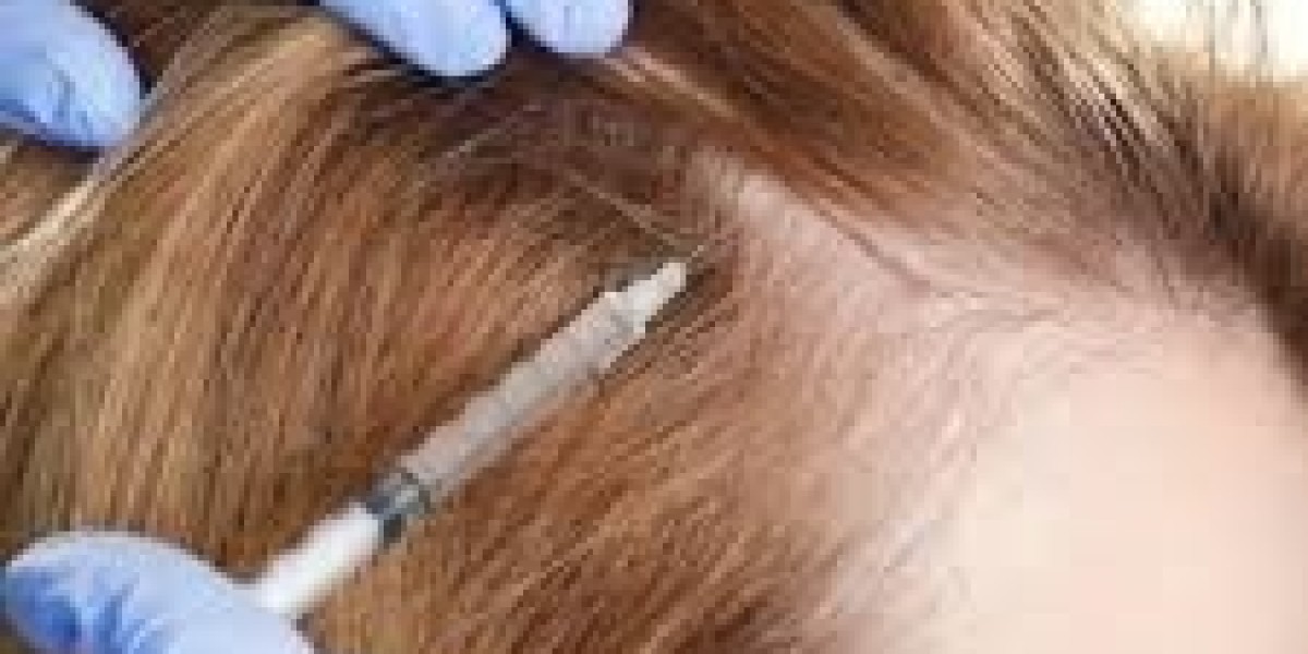 See the Power of PRP Hair Therapy at Dubai’s Top Clinics